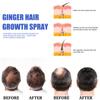30ML Ginger Hair Growth Spray Oil for Hair Care Hair Growth Products Hair Loss