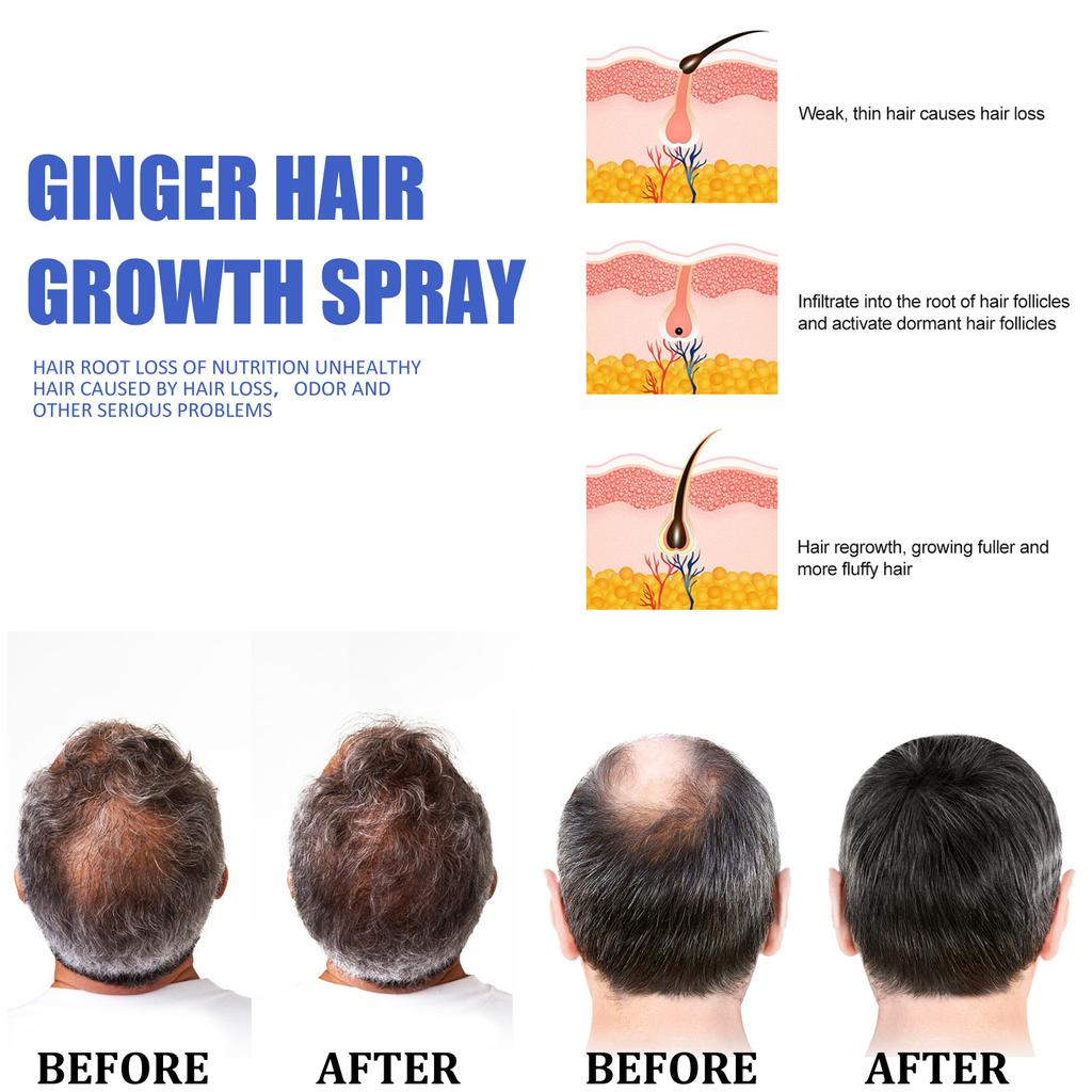 30ML Ginger Hair Growth Spray Oil for Hair Care Hair Growth Products Hair Loss