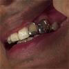 Hip Hop Teeth Jewelry Round Star Shape Dental Accessory Copper Texture Suitable for Adults Teens and Cosplay Enthusiasts