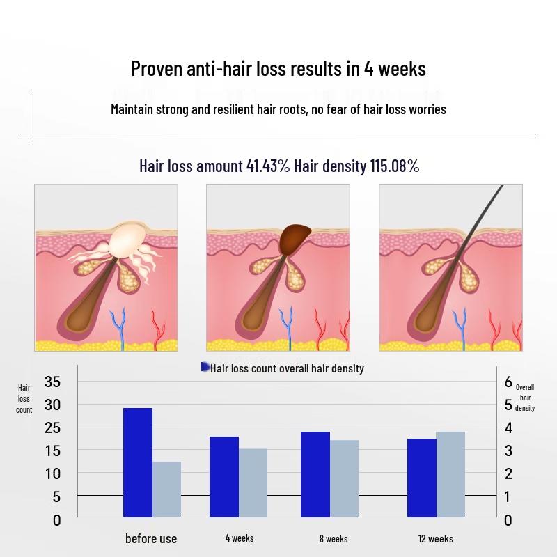EHD Anti-Hair Loss & Strengthening Shampoo