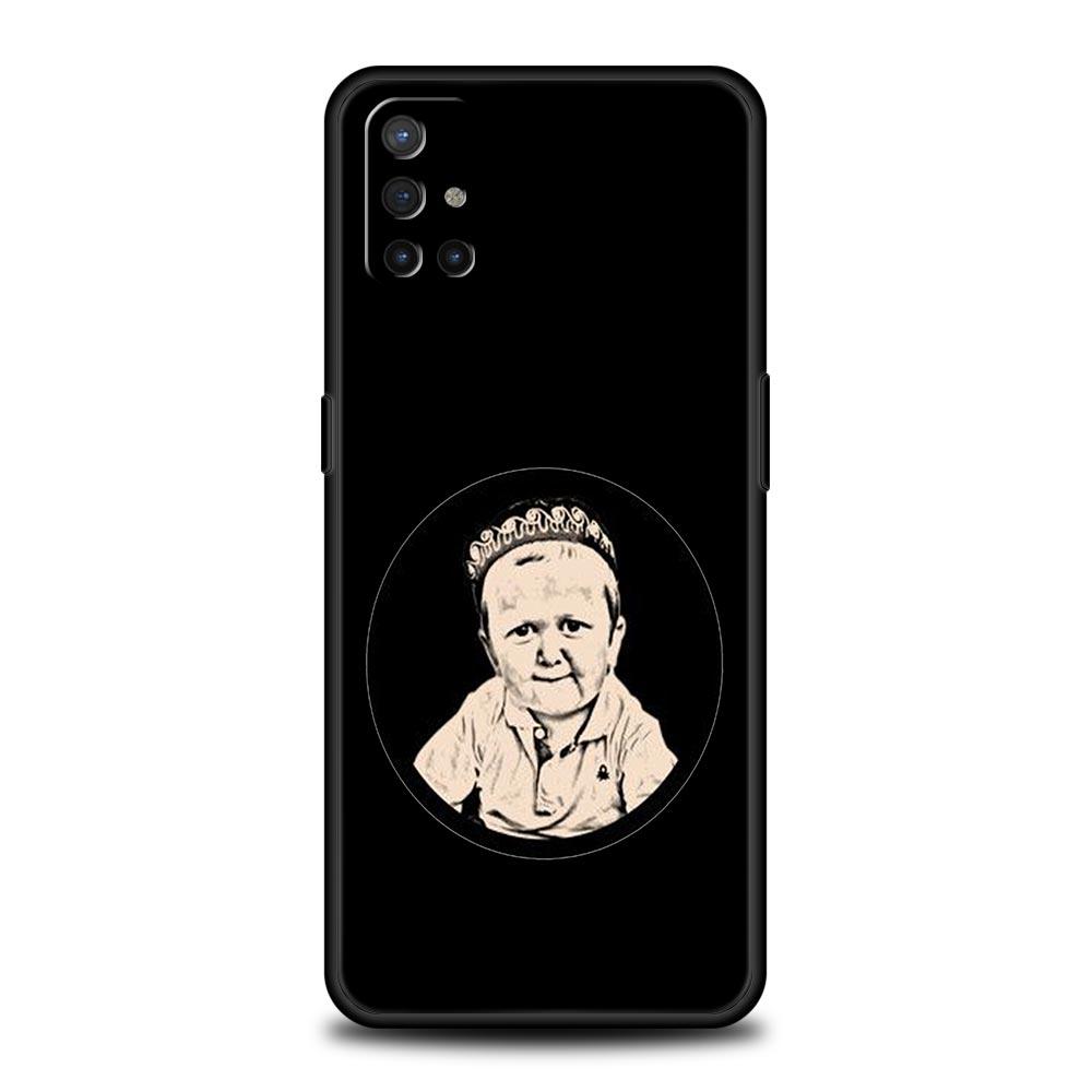 Funny Babaite Hasbulla Phone Case For OnePlus 15 13 12 11 10 9 8 15T 13T 10T 7T Pro 13R 12R 9RT 8T Nord 4 N10 2T CE 2 3 5G Cover
