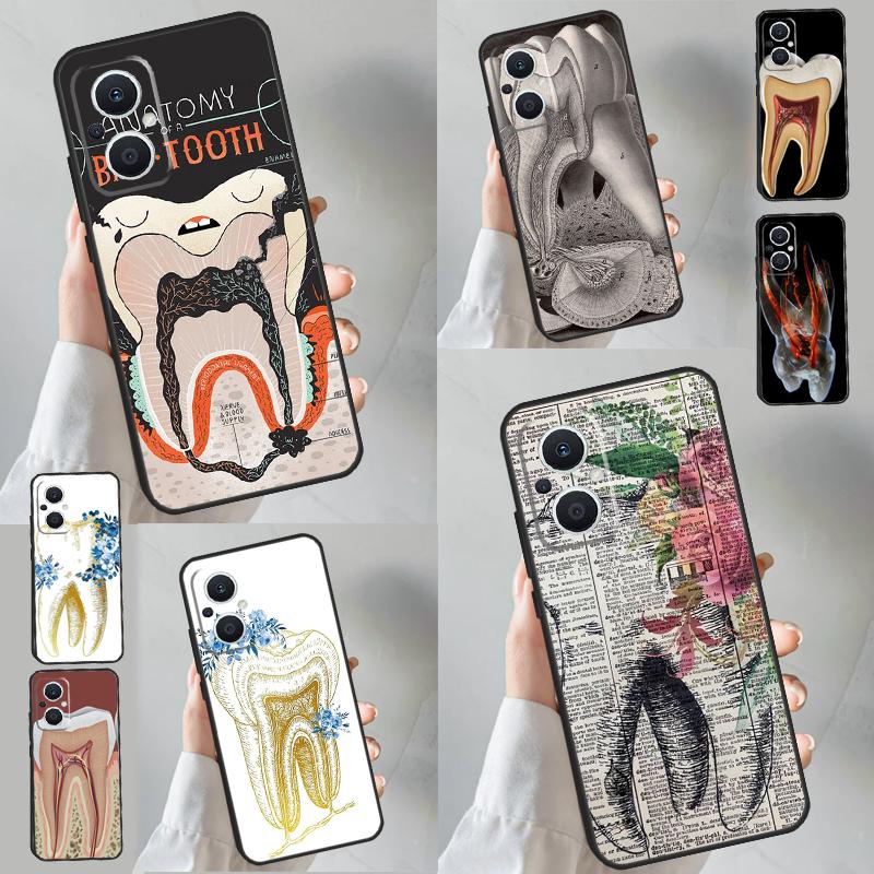 Human Tooth Anatomy Case For OPPO Reno 11 10 Pro 8 7 6 5 4 Lite 8T 5Z 4Z 11F OPPO Find X5 X6 Pro X2 Neo X3 Lite