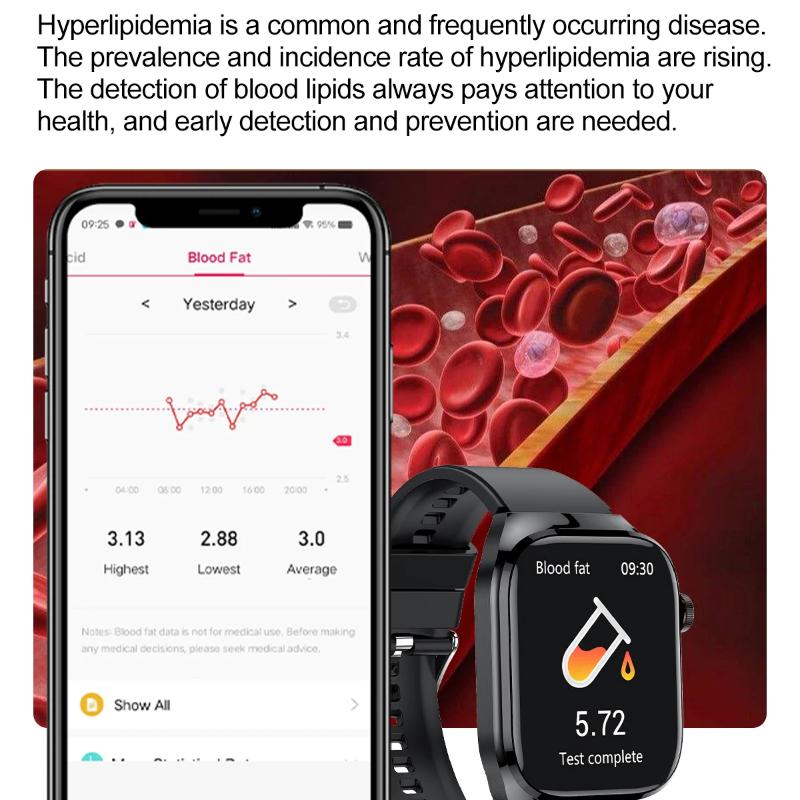 2025 Neue Mikro-Körperuntersuchung Smartwatch für Männer Harnsäure Körperfett Fünf Organe Gesundheitsuhren Bluetooth Anruf Smartarmband