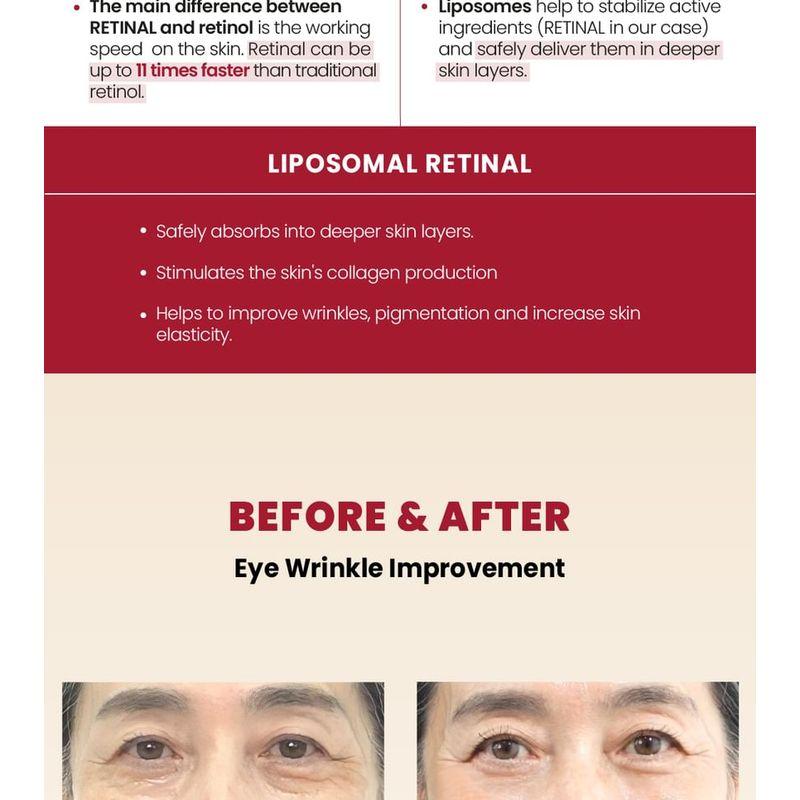 KSECRET SEOUL 1988 Eye Cream : Retinal Liposome 4% + Fermented Bean