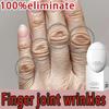 Hand Cream for Removing Wrinkles On Finger Joints, Removing Hand Wrinkles, and Reducing Joint Roughness and Blackness