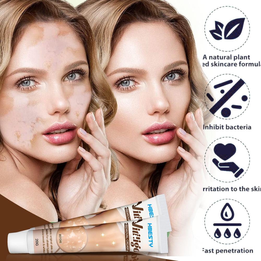 Body Gentle Whitening Cream For Skin Spot Care Formulated For All Skin Types