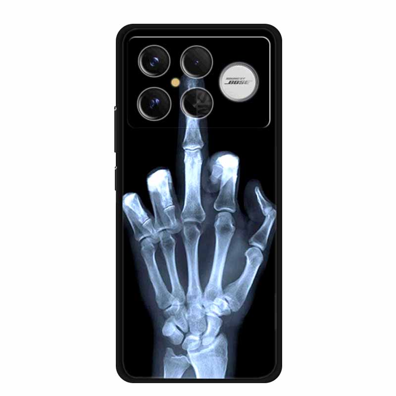 For Redmi K90 Pro Max Case Flowers Soft Silicone TPU Phone Cases for Xiaomi RedmiK90 Pro Max Shockproof Animals Protective Cover