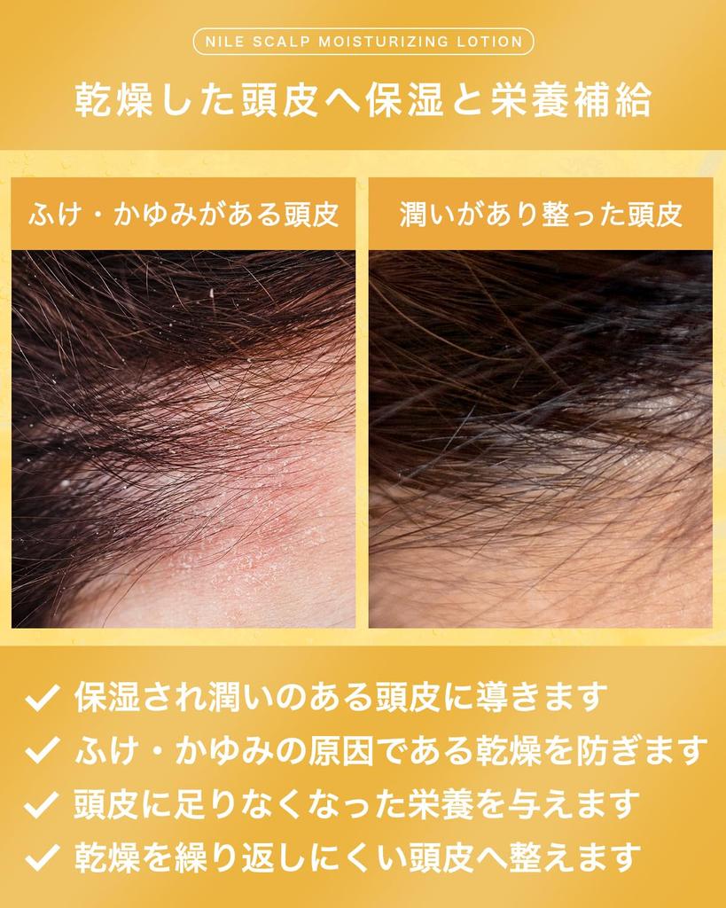 NILE Scalp Moisturizing Lotion for and Dryness Dandruff, Itching,