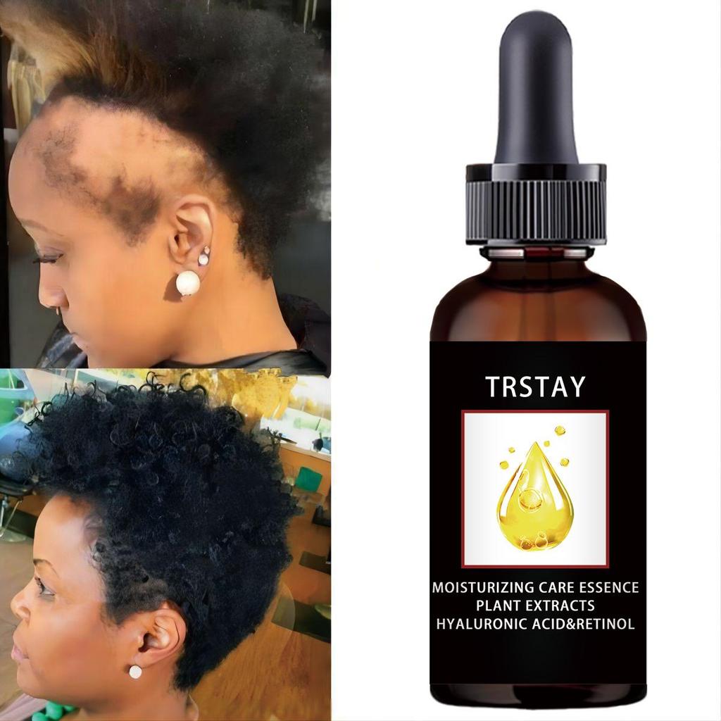 5ML/15ML/30ML/50ML/hızlı vahşi büyüme saç serumu yağı tedavisi saç dökülmesi için doğal öz erkekler kadınlar için kel noktalar için aşırı onarım