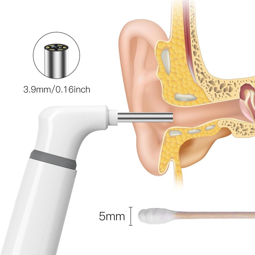 Teslong SA39W Xiaobai Portable HD WiFi Waterproof Ear Pick Otoscope