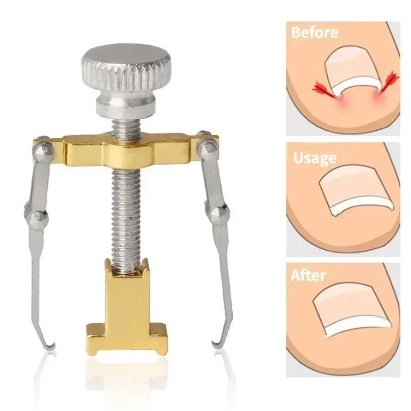 Nail Straighten Clip Ingrown Toenail Corrector Foot Nail Care Stainless Steel Pedicure Tools Treatment Health Care Toe Corrector