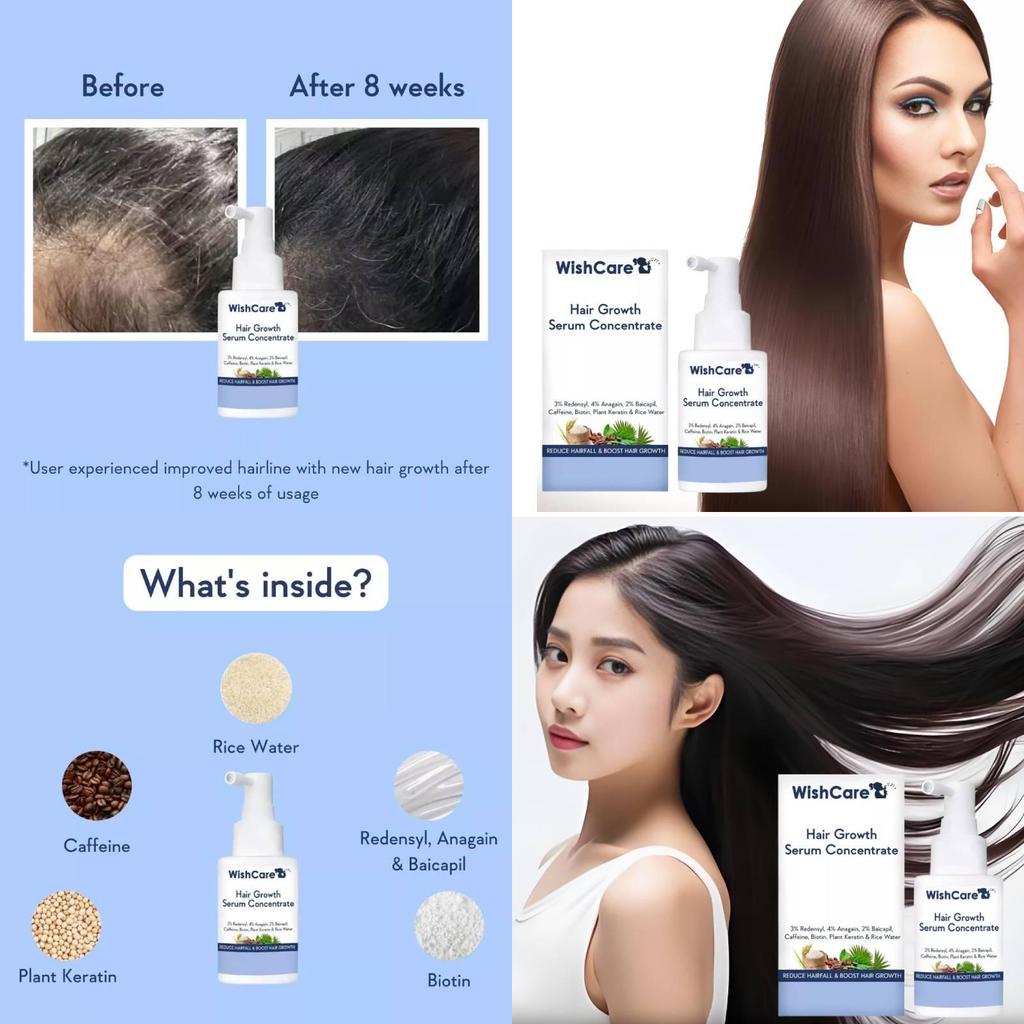 B3014 Hair Growth Concentrate Serum For Home Use With Luxurious Packaging For All Hair Types