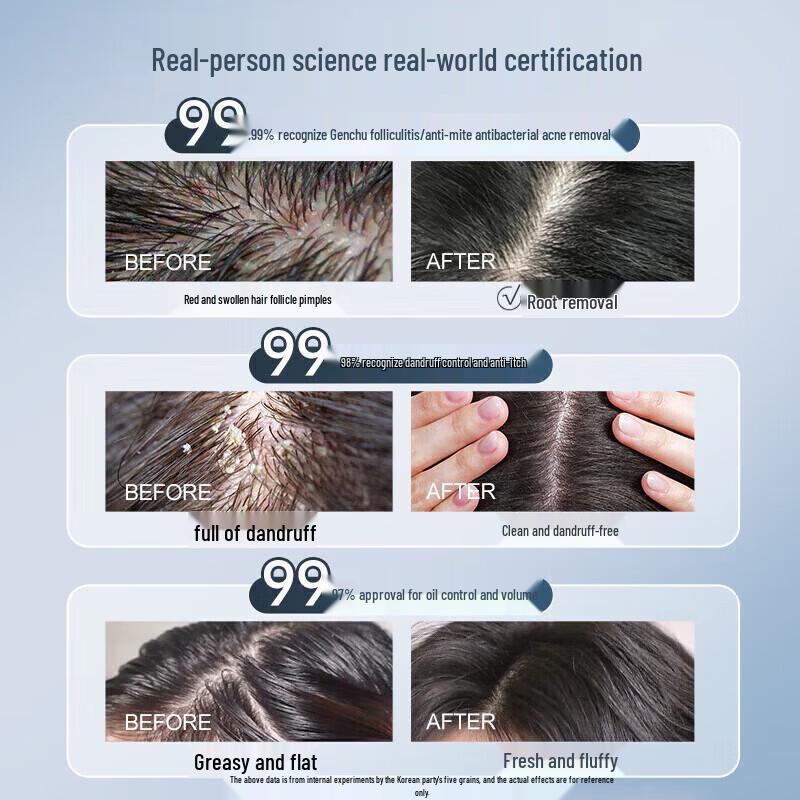 Korean Five Grains Follicle Refreshing Shampoo