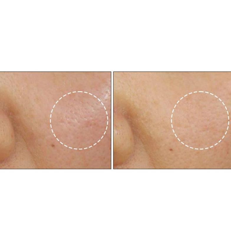 PURCELL Colostrum Pore Defense Ampulle 55ml