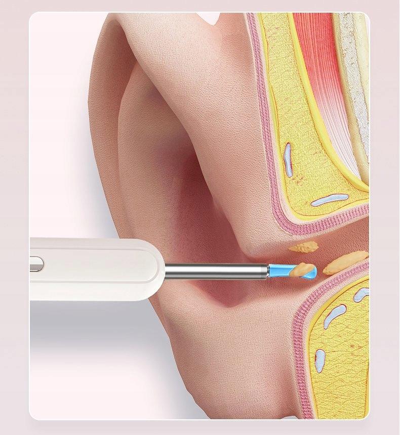 Otoscopic Ear Cleaning Wax Removal Wifi App Tel Android Ios Led 8Mp