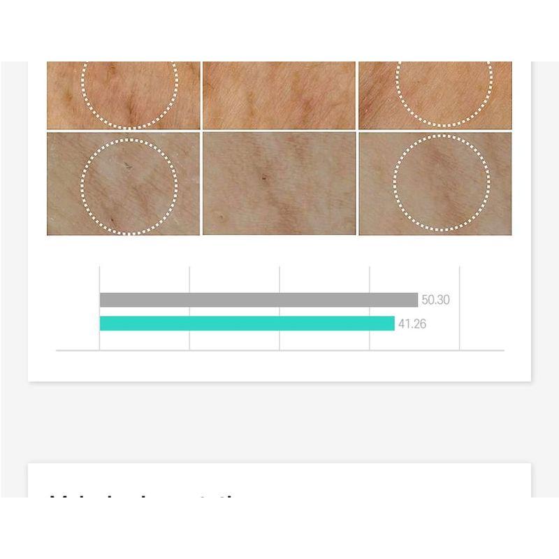 CARE:NEL - Anti-Melasma Cica Intensivserum