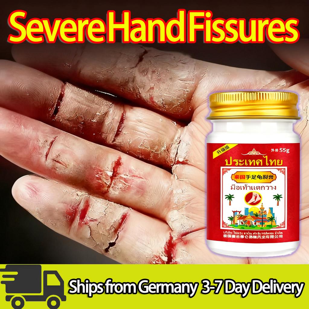 Dry and cracked fingers ointment, relieve pain and heal cracks, restore smooth skin