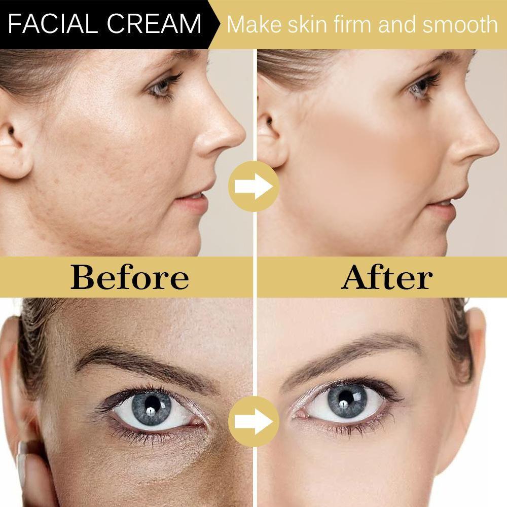 Whitening Moisturizer, Brightens Skin Tone, Moisturizes, Lightens Dullness, Tightens Skin