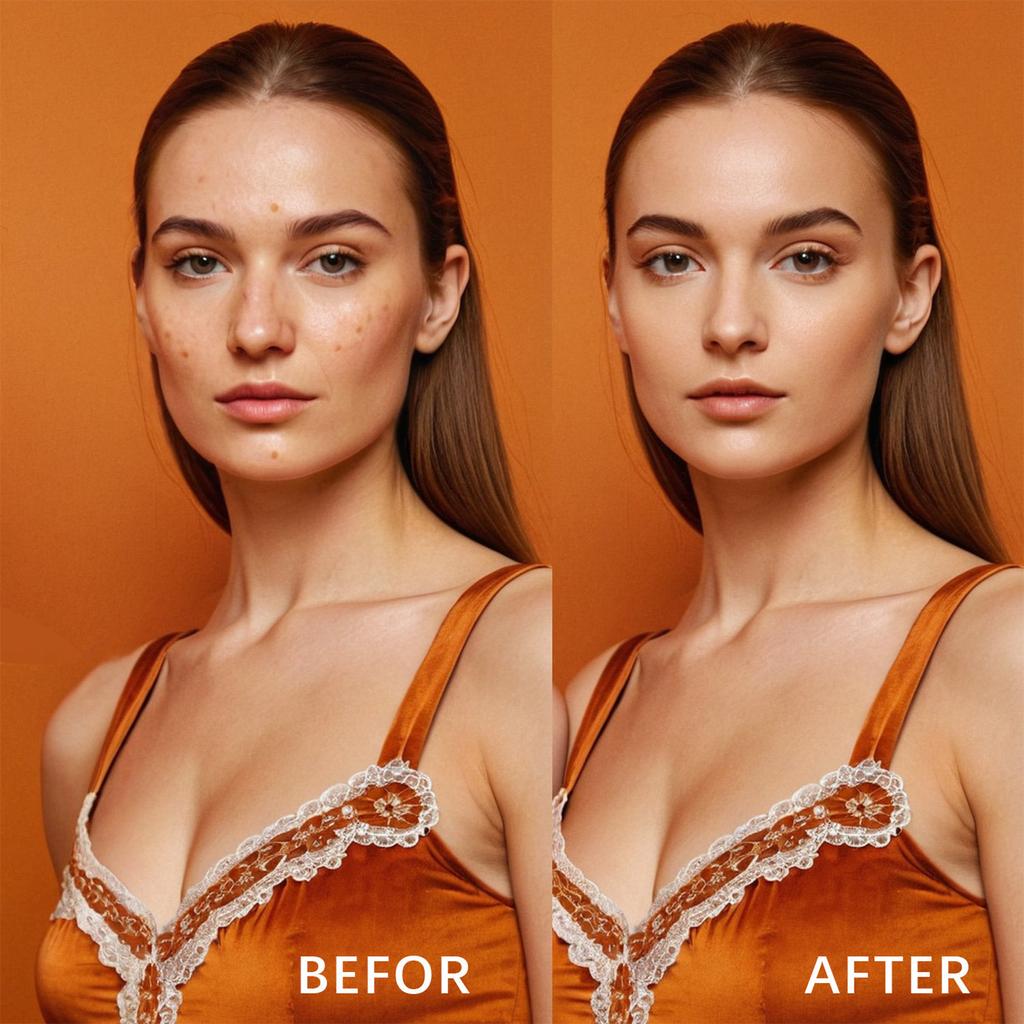 Acne Cream Skin Face Hydrating Moisturizing Acne Cream