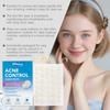 SOUTH MOON Face Acne Patch Invisible Pimple Patch Isolate Dust Prevent Picking No Makeup Caking Blemish Care