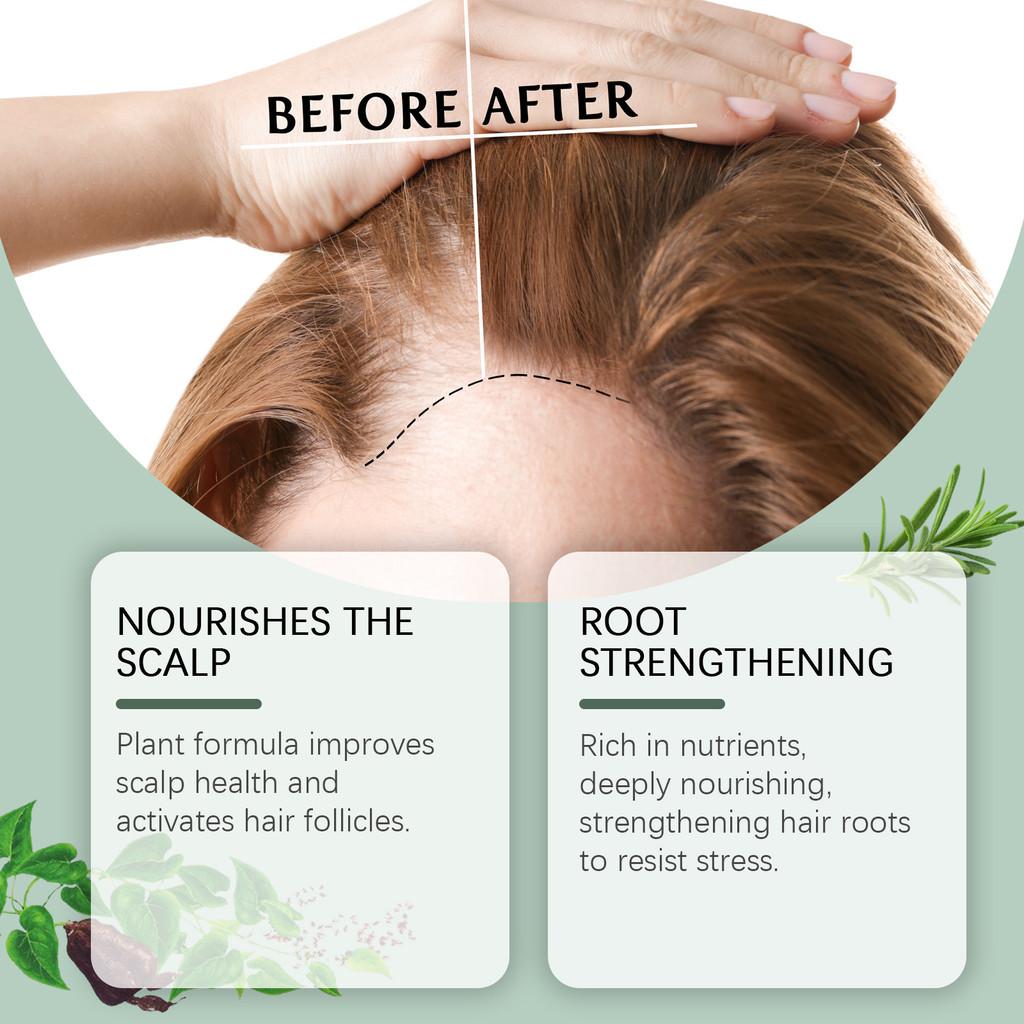 Hoegoa Rosemary Hair Care Spray For Nourishing Scalp And Thickening Dark Hair 100ml