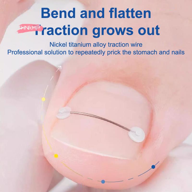 Ingrown Toenail Correction Tool with Elastic Patch Sticker Straightening Clip Brace - Toe Nail Treatment Pedicure Solution