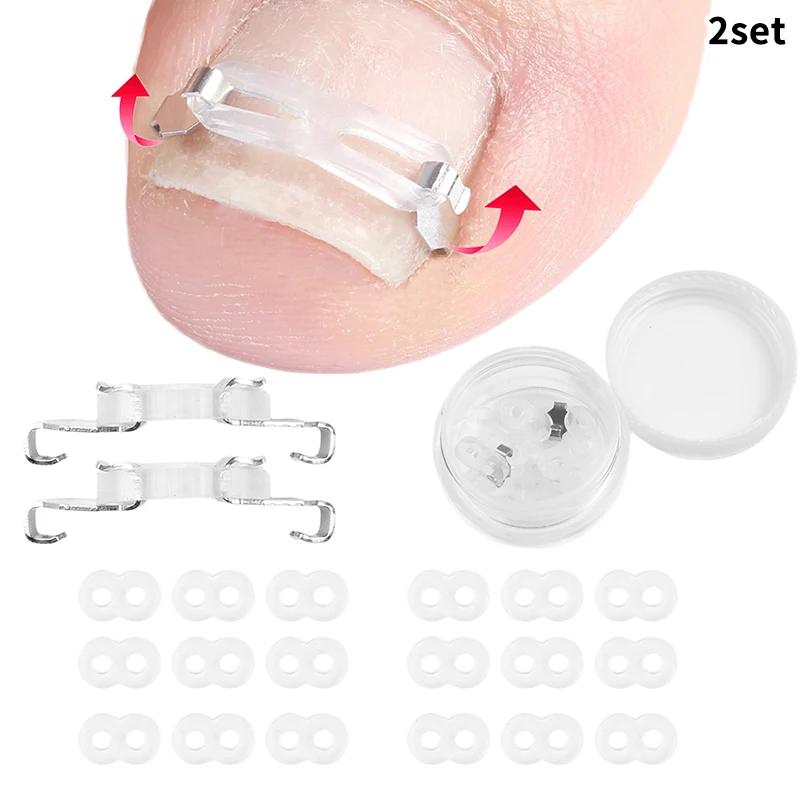Set Tool 1/2 Ingrown Toenail Corrector Pedicure Recover Embed Treatment Professional Foot Care Correction