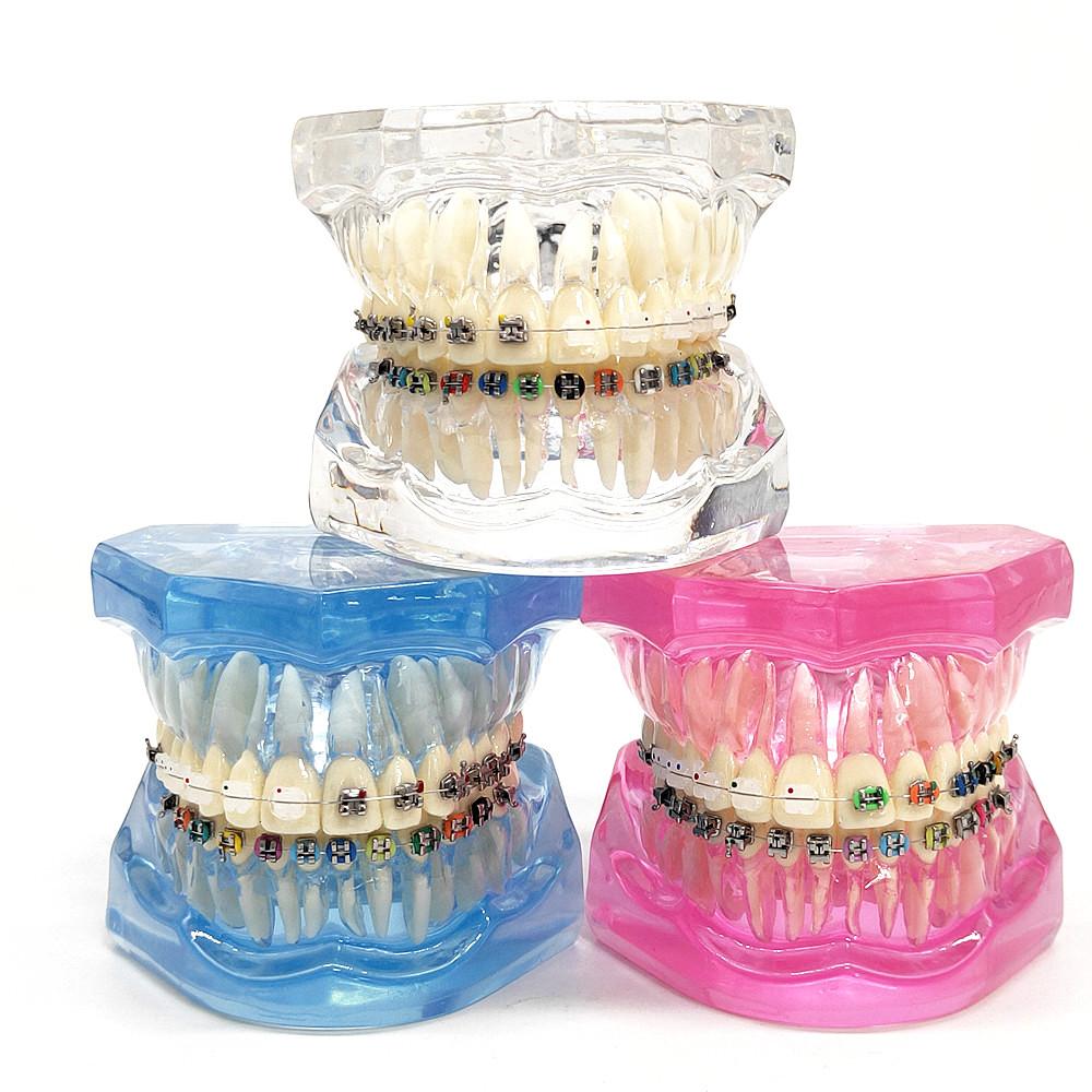 Dental Orthodontic Teeth Tooth Model 4 Kinds Brackets Ceramic and Metal Brackets for Patient Communication Dental Study Model