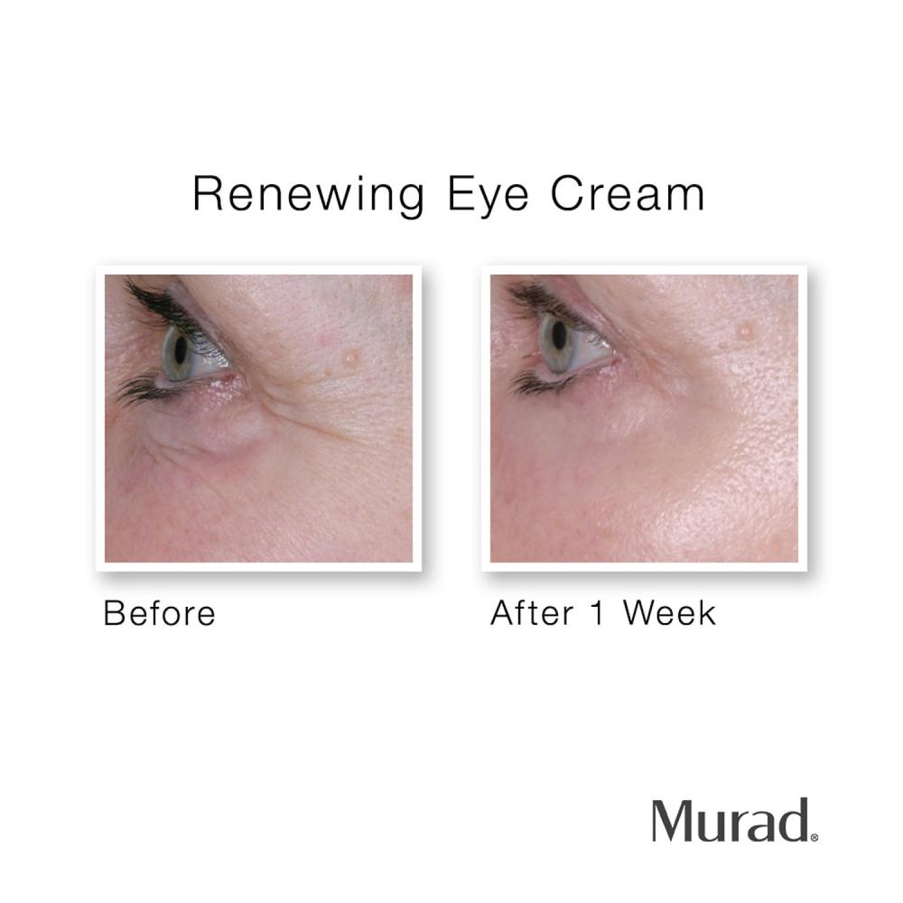 Murad Renewing Eye Cream