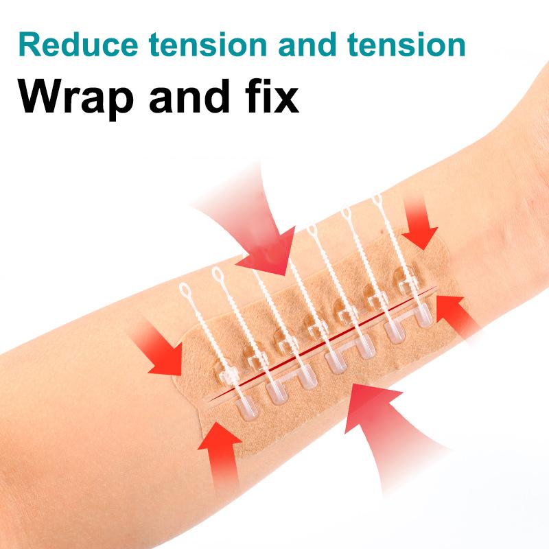 Zipper Tie Wound Closure Patch Hemostatic Patch Wound Fast Without Suture Zipper Outdoor Band-Aid Portable Quick Clot Wound
