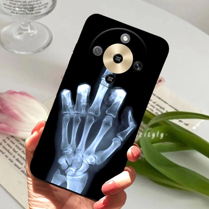 For Honor X9D Phone Case MTN-NX1 Cool Wolf Lion Silicone Back Cover For Honor Magic 8 Lite X 70 HonorX70 HonorX9d Soft TPU Funda