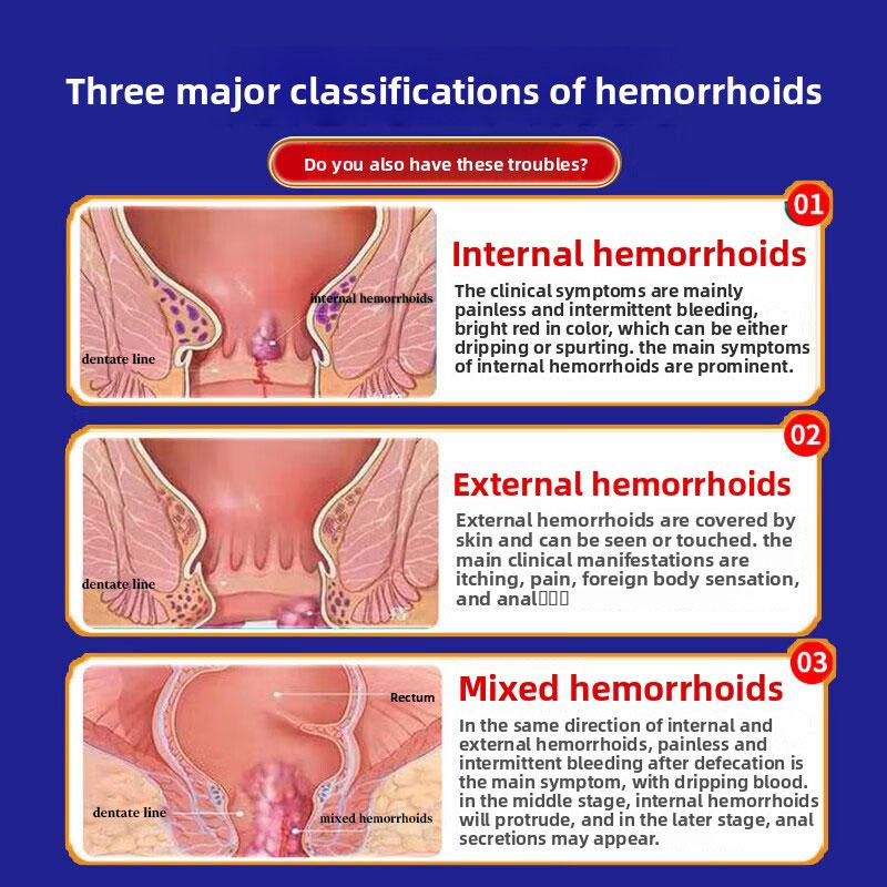 Natural Herbal Hemorrhoid Cream - Soothes Discomfort Gentle & Non-Irritating