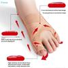 Adjustable Bunion Corrector - Toe Straightener Splint for Foot Support