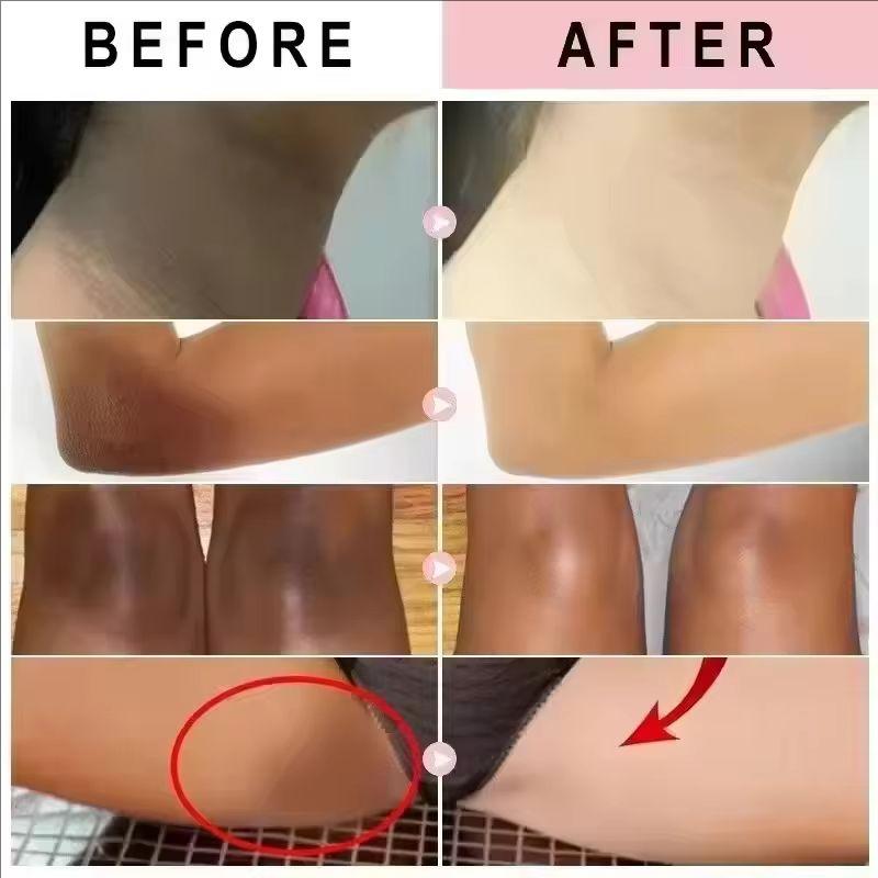 Vitamin E Moisturizing and Whitening Cream - Reduces Melanin, Brightens and Tightens the Skin, and Improves Dry and Peeling Skin