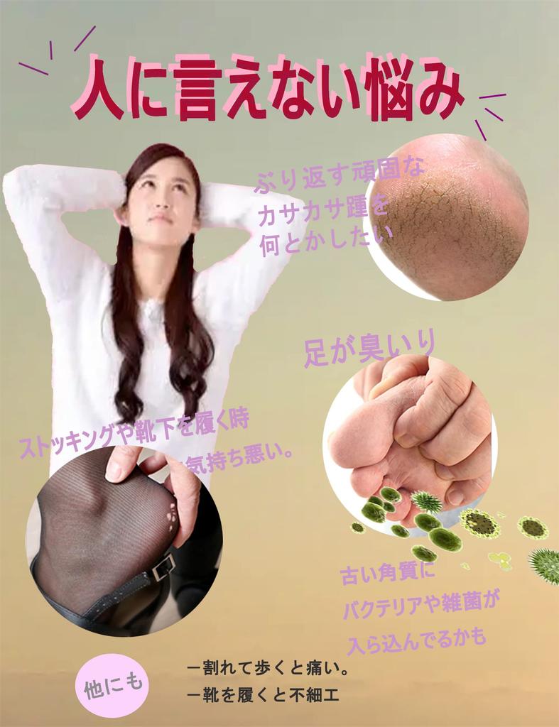 Heel Callus Heel Heel Pumice Easy To Lanyard for Heel Cracked Soles of Heel Foot Care Gold Remover, Care, Roughness, Calluses, File, Stone, Glass,