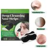 Blackhead Nose Strips, 30 pcs
