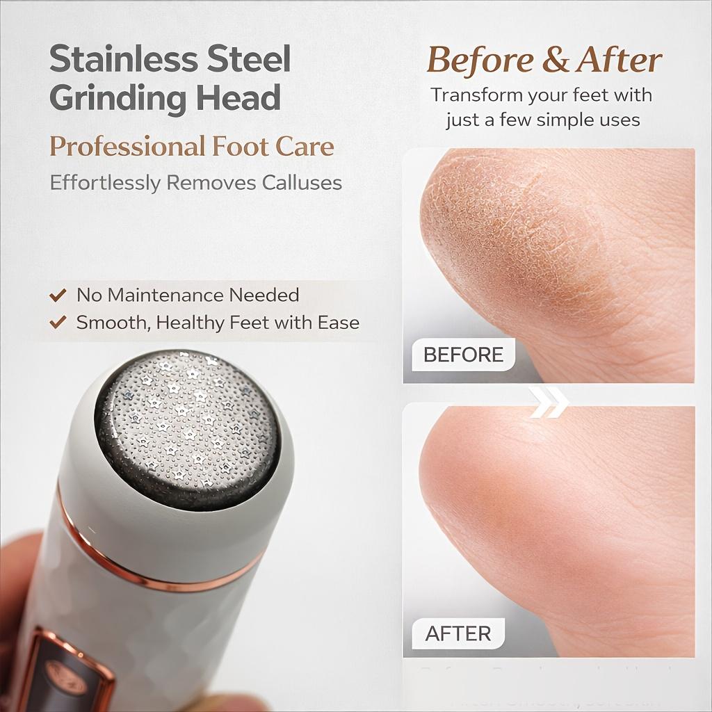 Electric foot grinder automatic exfoliator callus removal tool portable electronic foot pedicure one-button control for removing hard and cracked skin