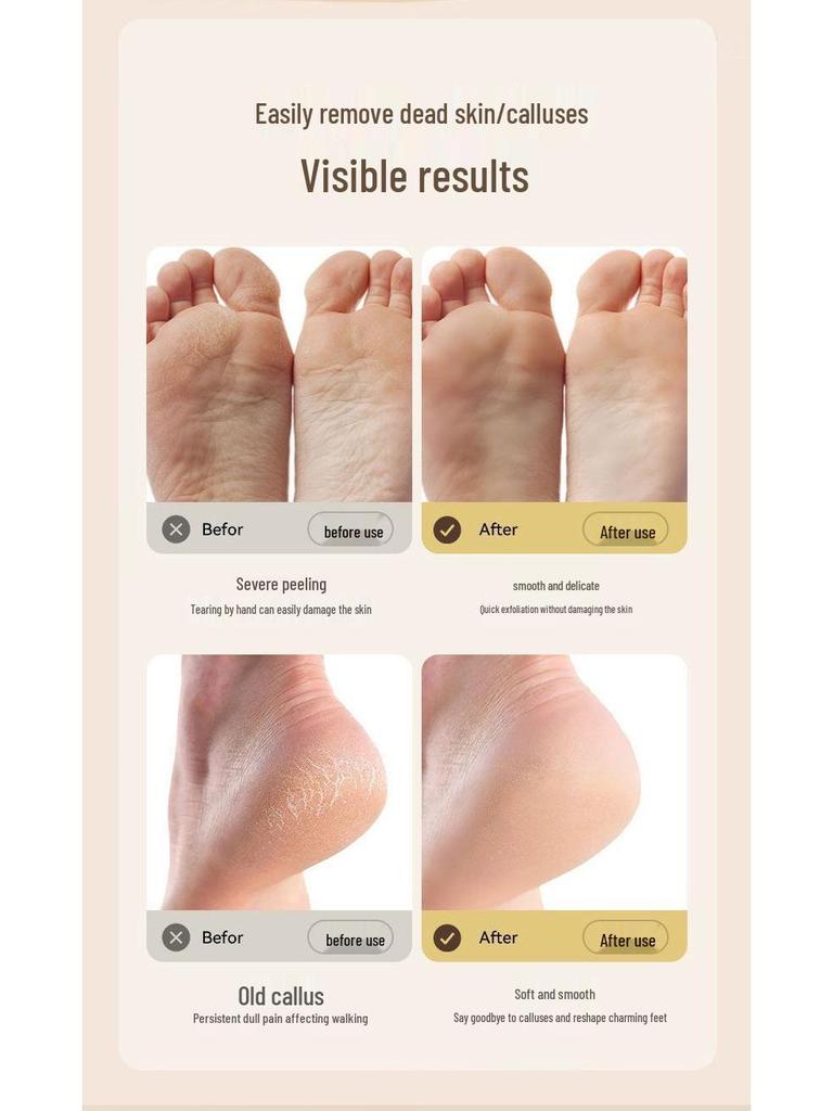 Wasserdichte elektrische Fußfeile & Hornhautentferner mit Staubsauger zur Pflege abgestorbener Haut