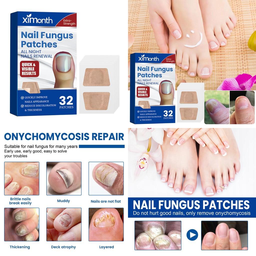 Ximonth Nail Care Patches Repairing Thickening Strengthening For Damaged Nails