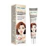 Vitiligo Cream, Anti-Vitiligo Cream, Natural Vitiligo Treatments Cream for Skin, Reduce White Spots and Improve Skin Pigmentation, 20g