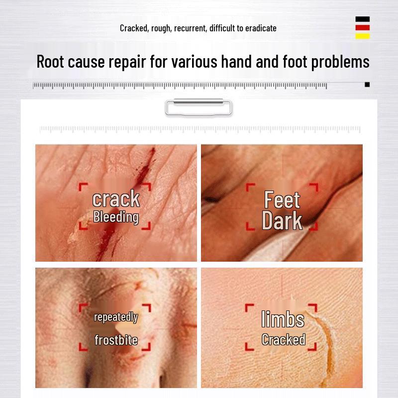 BEAI Cracked Heel & Hand Repair Cream