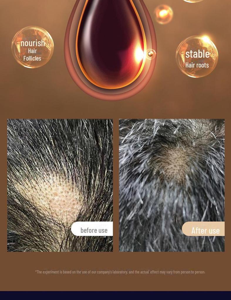 Cross-border EMS Microcurrent Hair Growth Comb & Scalp Massager with Applicator