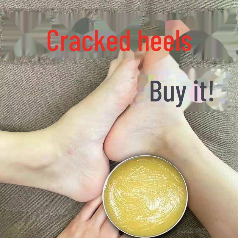 Winter Protection Cream: Moisturizes, Repairs Cracked Hands & Feet, Exfoliates, Heals Dry Skin