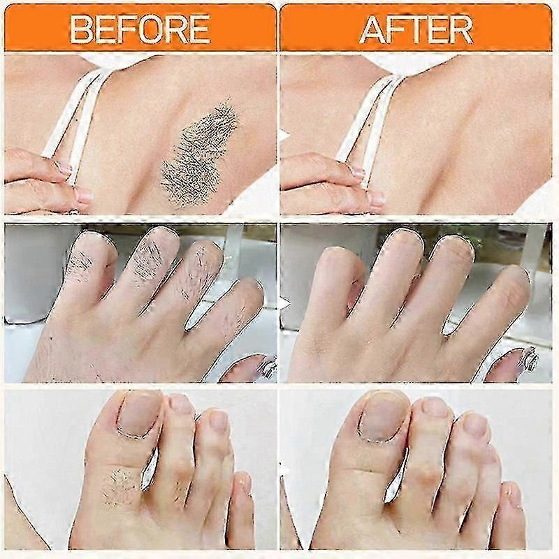 Joypretty Depilační krémy Rychlé šetrné odstranění Péče o pleť Bělení Odlíčení chloupků na horním rtu Podpaží Depilační krém Pro ženy Krása