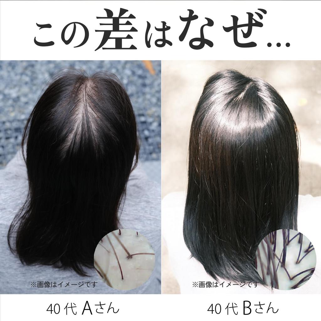 Haru Medicated Scalp Essence 100, 130ml (approximately 2-month Supply), Quasi-drug, Women's Hair Growth Tonic, Hair Growth Support