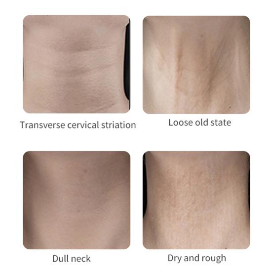 Neck Tape Instant Lifting Patch Waterproof Invisible Neck Strap Wrinkles Saggy Skin Neckline Remover for Necks Face Jaw