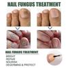 Extrem starke Nagelpilzbehandlung, beste Nagelreparatur Stoppt Pilzwachstum Effektiv