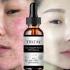 5ML/15ML/30ML/50ML/TRSTAY rezolvă problemele pielii și vă menține fața blocată în apă fără probleme, menținând-o umedă