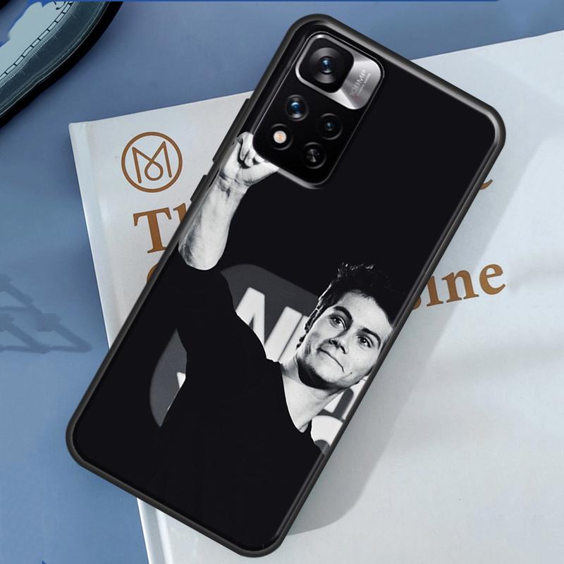 Teen Wolf Dylan Obrien Case For Xiaomi Redmi Note 14 13 Pro 12 11 9 10 9S 10S 11S 12S Redmi 13C 10C 12C 14C Cover