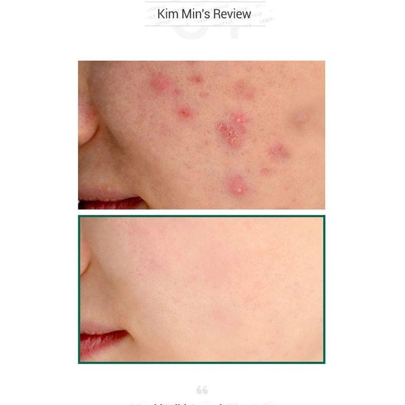 SOME BY MI AHA, BHA, PHA 30 Days Miracle Serum 50ml